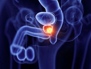 Eroprostin leczy prostatę i problemy z oddawaniem moczu